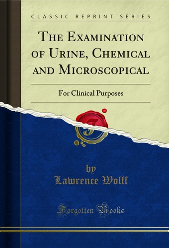 The examination urine - examination,